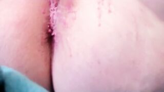 Anus spanked and treated with hot wax