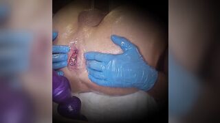 Milk anal enema, the first? anal fetish ?????