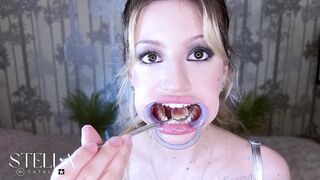 Teeth Fetish Bizarre Close-up Dental Examination