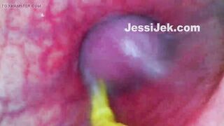 Plumber's Endoscope Stuk in My Ass Showed Hot Anal Creampie From Inside