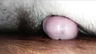 After Taking Viagra My Erection Lasted Longer Than twenty Four Hours
