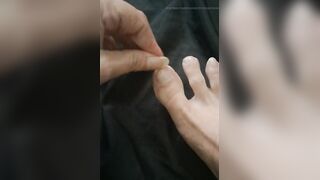 Long Toenail Clipping