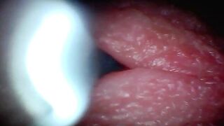 Endoscope Camera Captures Moment of Boy Ejaculation 4K