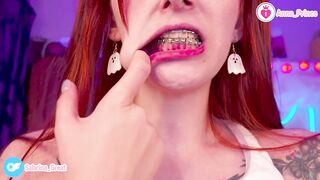 SFW Braces Elastics Close-Up