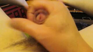 Masturbe (210) with one testicle