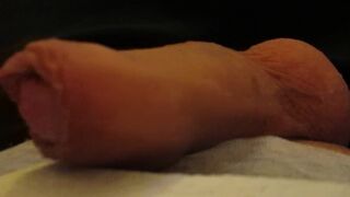 Masturbe (287) with one testicle