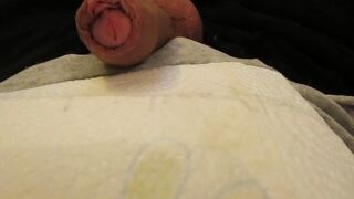 Masturbe (287) with one testicle