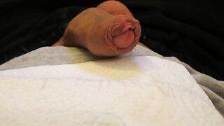 Masturbe (287) with one testicle