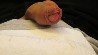 Masturbe (287) with one testicle