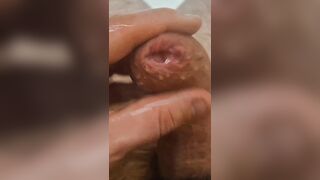 Real Phimosis Jock and Tight Foreskin Close-Up pleasure