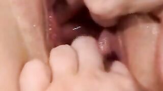 Pregnant and mature in pussy dilation