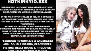 Lesbians Hotkinkyjo & Anuskatzz anal double fisting, elbow deep fisting, belly bulge & prolapse