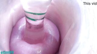 Lesbians cervix play penetration, fingering and piss directly into the bladder of the other woman by peehole
