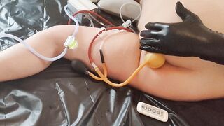 Giant abdomen inflation using my enema machine and inflatable bardex nozzle