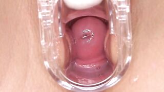Cervix blond