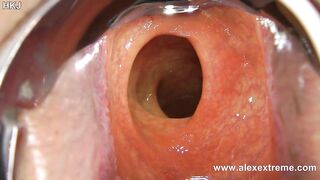 Incredible deep anal view with XO speculum and light in Hotkinkyjo butt