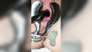 Peehole play 18