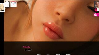Melody 20