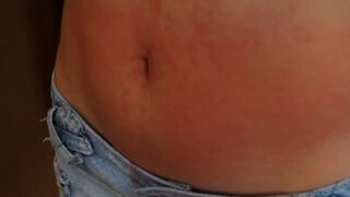 I show my red stomach from the torture I received from the red belly game, my abdomen inflamed