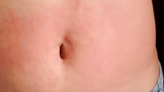 I show my red stomach from the torture I received from the red belly game, my abdomen inflamed