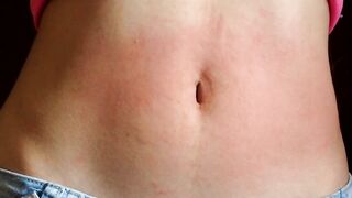 I show my red stomach from the torture I received from the red belly game, my abdomen inflamed