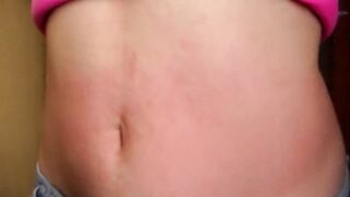 I show my red stomach from the torture I received from the red belly game, my abdomen inflamed